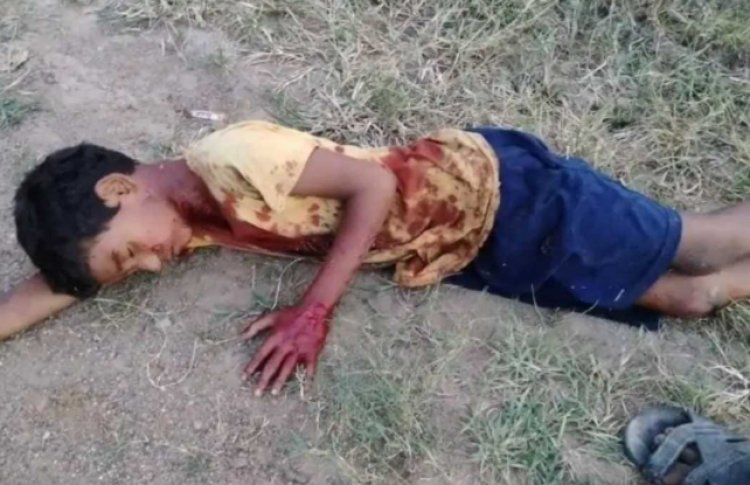 13 साल के मासूम पर मामा का हमला, मरने का नाटक कर बचाई जान